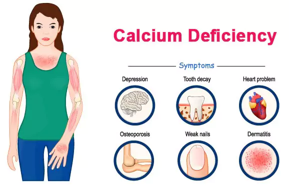Calcium Deficiency